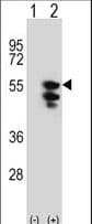 EFTU / TUFM Antibody (aa75-104)