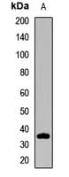 Polyclonal Rabbit anti-Human ELMOD2 Antibody (WB)