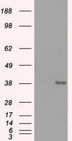 Monoclonal Mouse anti-Human SORD / Sorbitol Dehydrogenase Antibody (clone OTI9E7, IHC, IF, WB)