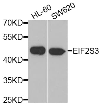 EIF2S3 / EIF2G Antibody