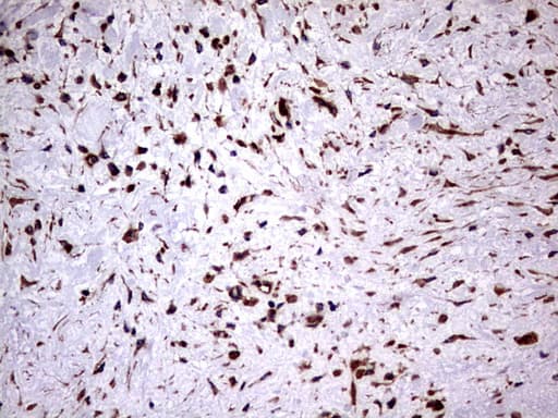 KRT7 / CK7 / Cytokeratin 7 Antibody (clone OTI2A2)