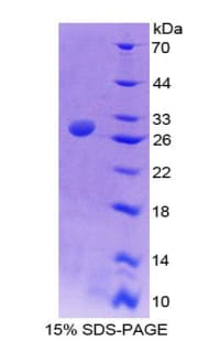 Human NUP50 Protein (Recombinant His-T7)