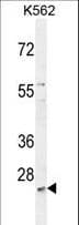 SLC25A52 Antibody (aa46-75)