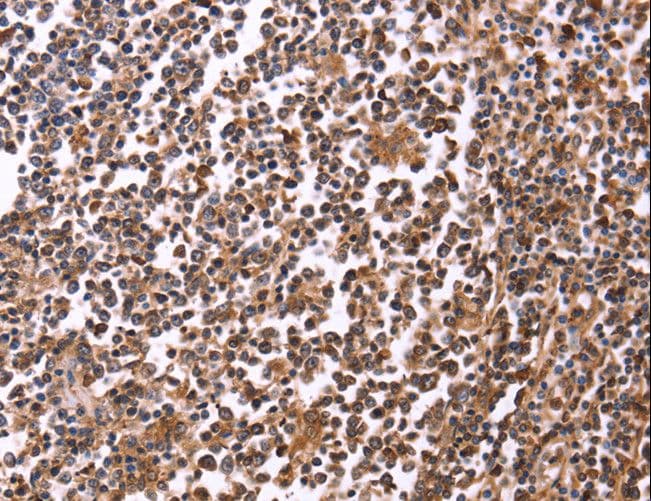 Polyclonal Rabbit anti-Human CRK Antibody (IHC)