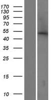 ABHD16B / C20orf135 Protein (Over-Expression Lysate Myc-DDK (Flag))