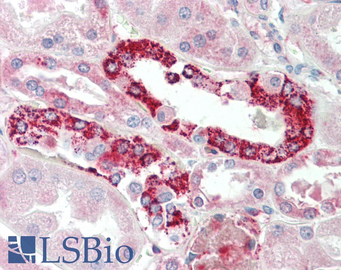 IHC-plus™ PLK3 Antibody (aa320-333)