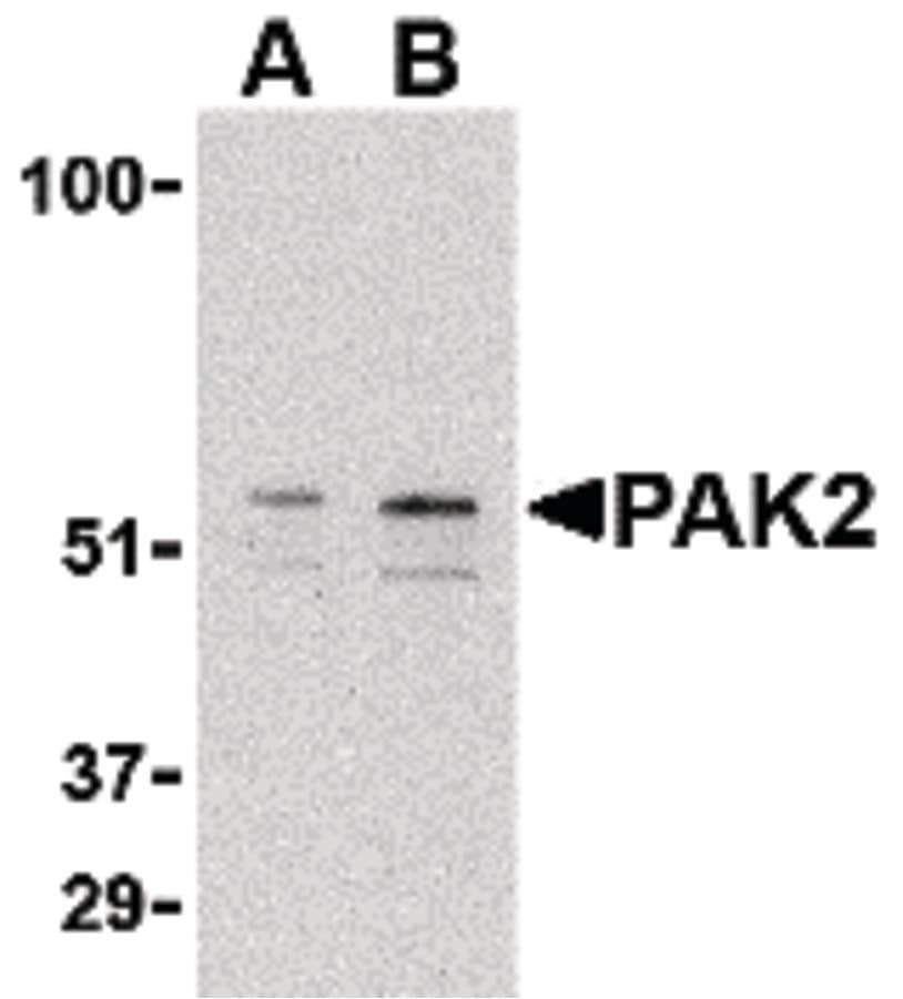 IHC-plus™ PAK2 Antibody