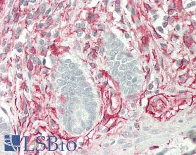 IHC-plus™ Monoclonal Mouse anti-Human PROCR / EPCR Antibody (clone 5E12, aa1-210, IHC, WB)