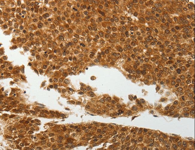 SOCS7 / SOCS-7 Antibody