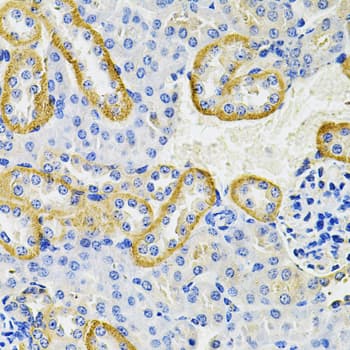 KRT20 / CK20 / Cytokeratin 20 Antibody