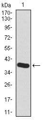 Monoclonal Mouse anti-Human HAS2 Antibody (clone 40000000, Amino Acid: 67-170, IHC, IF, WB)