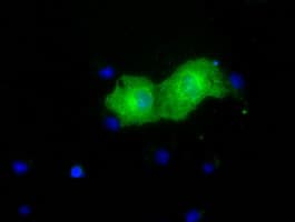 PKLR Antibody (clone OTI1H2)