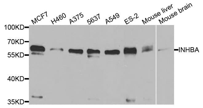 IHC-plus™ INHBA / Inhibin Beta A Antibody