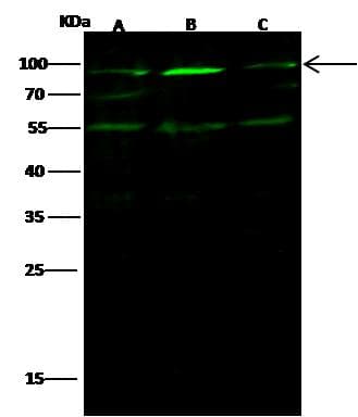 Monoclonal Mouse anti-Human EZR / Ezrin Antibody (clone 02, Preservative Free, WB)