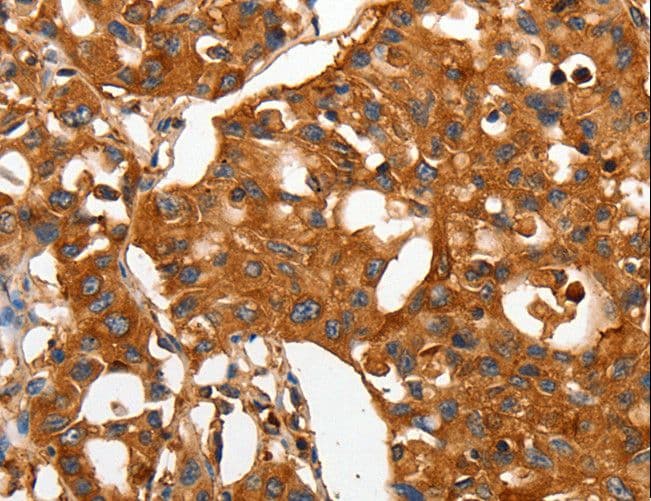 Polyclonal Rabbit anti-Human CAP2 Antibody (IHC, WB)