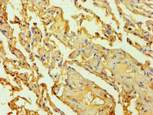 Polyclonal Rabbit anti-Human HTR2B / 5-HT2B Receptor Antibody (IHC)
