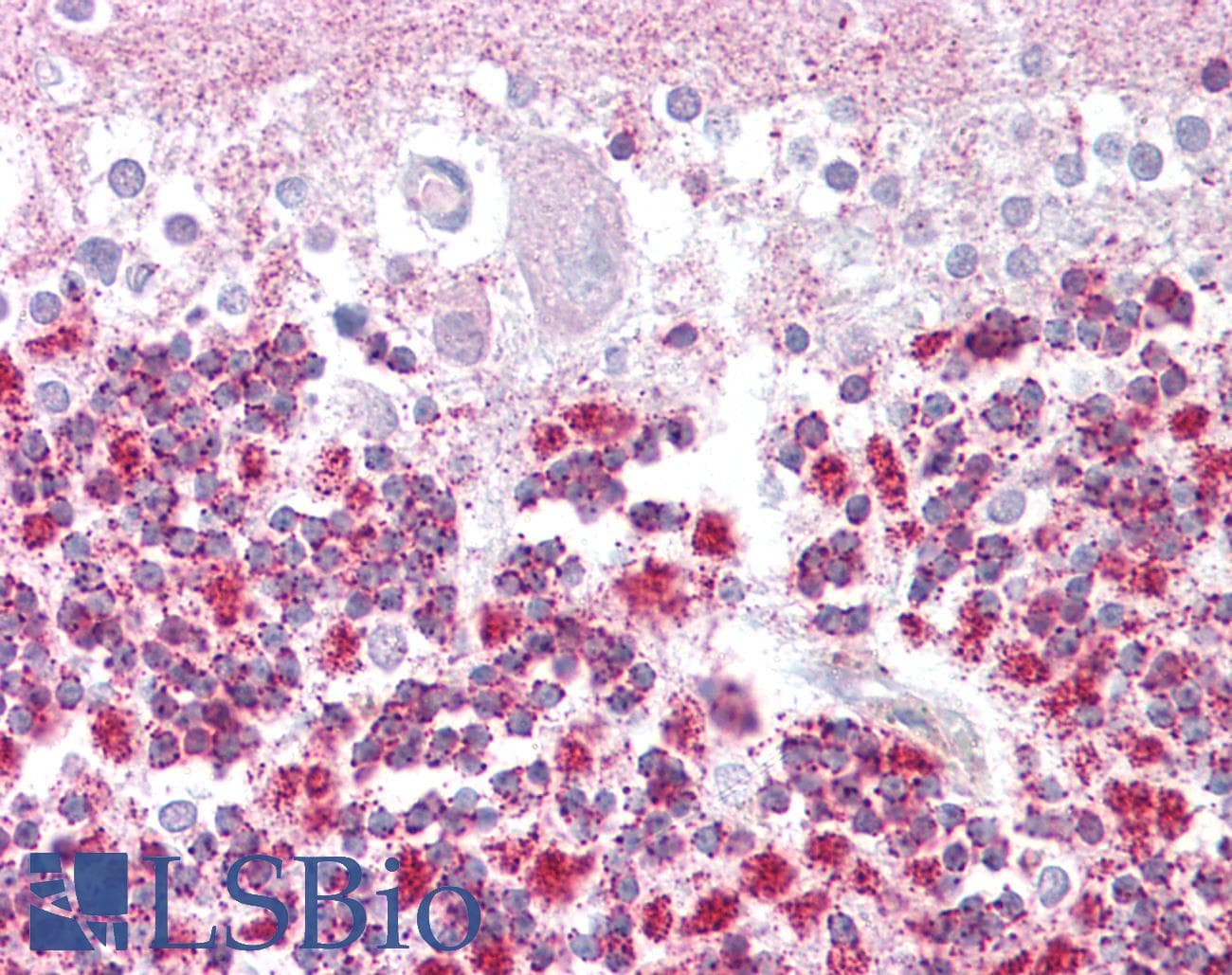 IHC-plus™ EPM2A / Laforin Antibody (aa131-144)