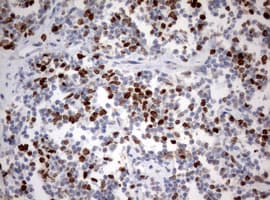 Monoclonal Mouse anti-Human MKI67 / Ki67 Antibody (clone OTI1F11, Carrier-free, aa1160-1493, IHC, WB)