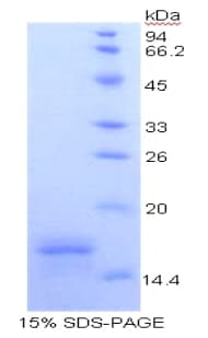 Human CD40L Protein (Recombinant His, N-Terminal)