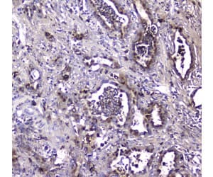 Polyclonal Rabbit anti-Human MAC-2-BP / LGALS3BP Antibody (IHC, WB)