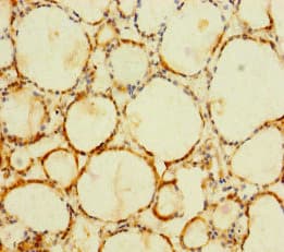 Polyclonal Rabbit anti-Human C1orf112 Antibody