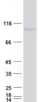 Human DISC1 Protein (Recombinant Myc-DDK (Flag))