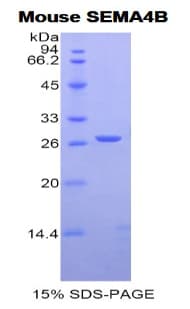 Mouse SEMA4B / Semaphorin 4B Protein (Recombinant His)