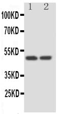 SERPINA4 / Kallistatin Antibody (aa384-401)