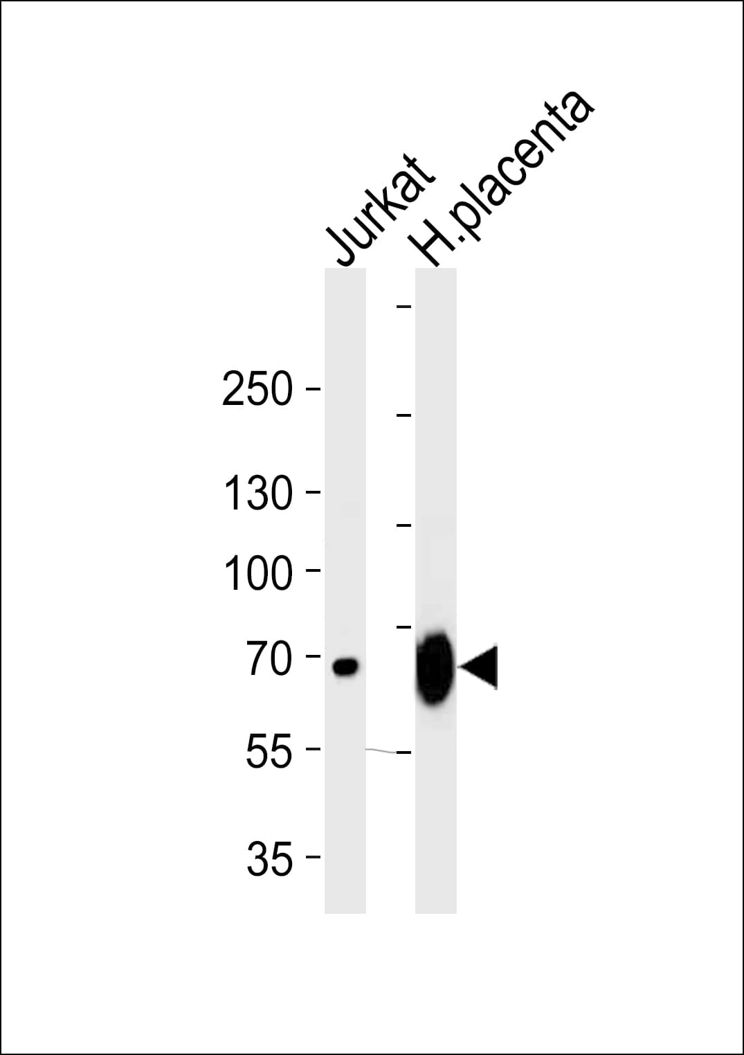 LIMK2 Antibody (aa570-599)