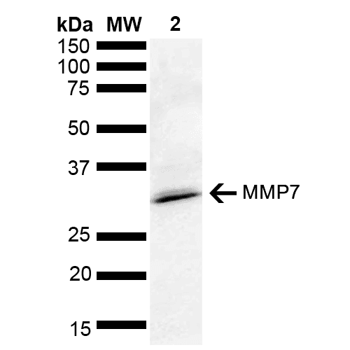 MMP7 / Matrilysin Antibody (PerCP)