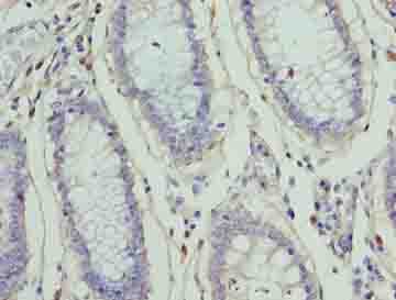 Polyclonal Rabbit anti-Human ZNF555 Antibody (IHC, WB)