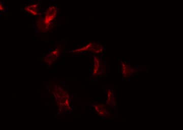 Polyclonal Rabbit anti-Human CSF2RA / CD116 Antibody (IF, WB)