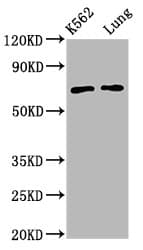 Polyclonal Rabbit anti-Human POF1B Antibody (WB)