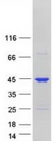 Human CCDC92 Protein (Recombinant Myc-DDK (Flag))