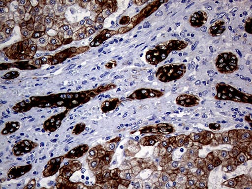 KRT8 / CK8 / Cytokeratin 8 Antibody (aa91-381, clone OTI2F5)