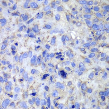 Polyclonal Rabbit anti-Human CASP7 / Caspase 7 Antibody (IHC, IF, WB)