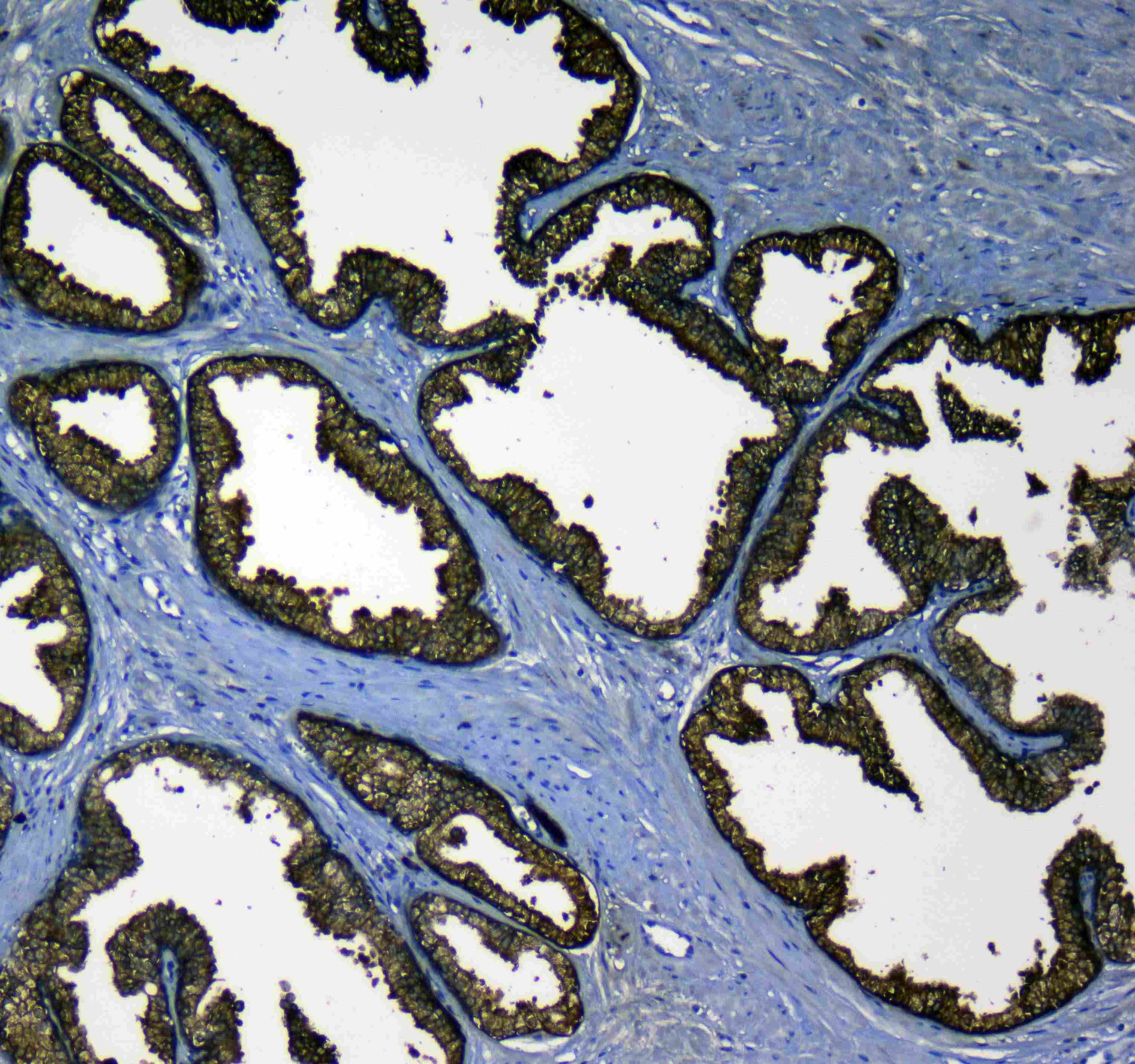 KLK2 / Kallikrein 2 Antibody