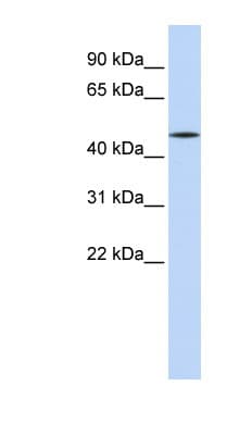 Polyclonal Rabbit anti-Human HNF4A / HNF4 Antibody (aa252-301, WB)