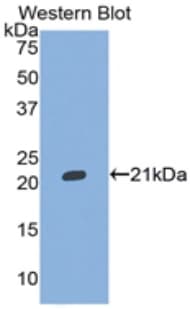 ITIH5 Antibody (aa569-737, PE)