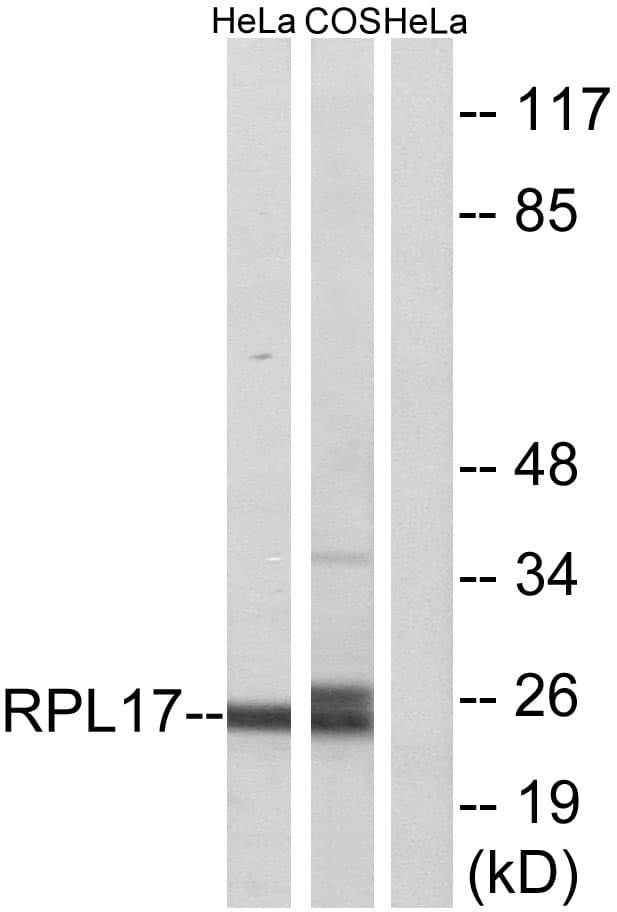 IHC-plus™ RPL17 / Ribosomal Protein L17 Antibody (aa101-150)