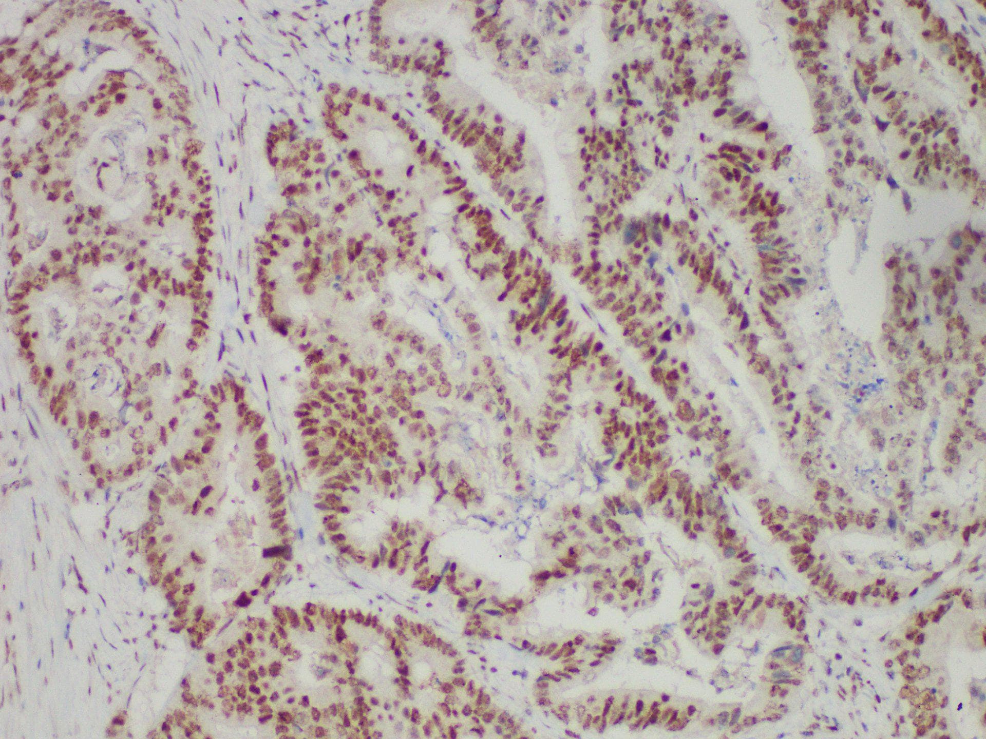 PMS2 Antibody