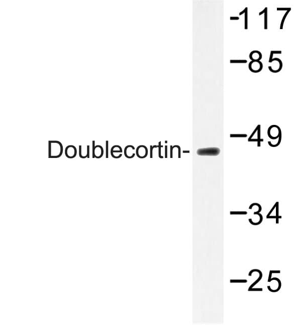 Polyclonal Rabbit anti-Human DCX / Doublecortin Antibody (Lys292, IHC, WB)
