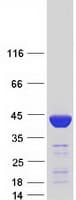 Human FBP1 Protein (Recombinant Myc-DDK (Flag))
