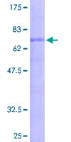 Human WNT2B Protein (Recombinant GST)