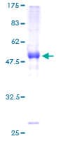 Human BAMBI Protein (Recombinant GST)