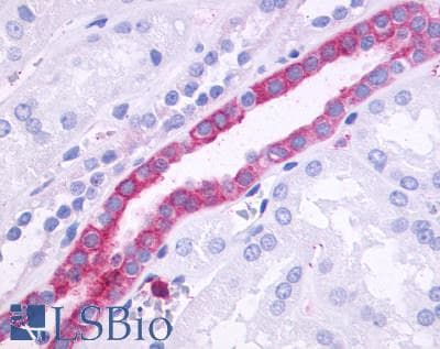 PathPlus™ Polyclonal Rabbit anti-Human ADGRF1 / GPR110 Antibody (N-Terminus, IHC)