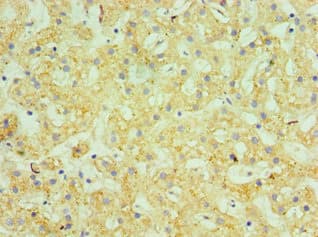 GUSB / Beta Glucuronidase Antibody (aa382-651)