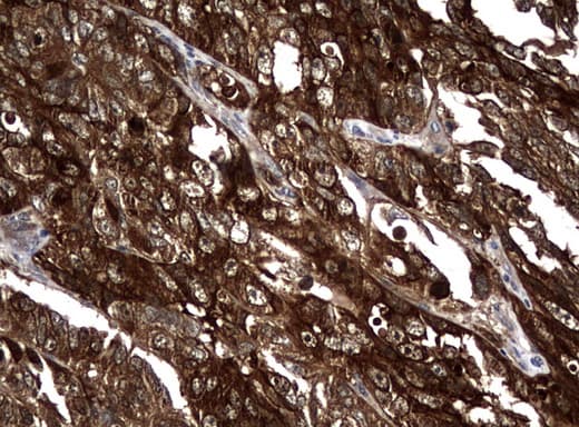 Monoclonal Mouse anti-Human NME1 / NM23 Antibody (clone UMAB93, IHC, IF, WB)