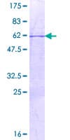 Human TLX3 Protein (Recombinant GST)