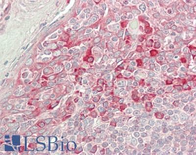 IHC-plus™ CKAP4 Antibody